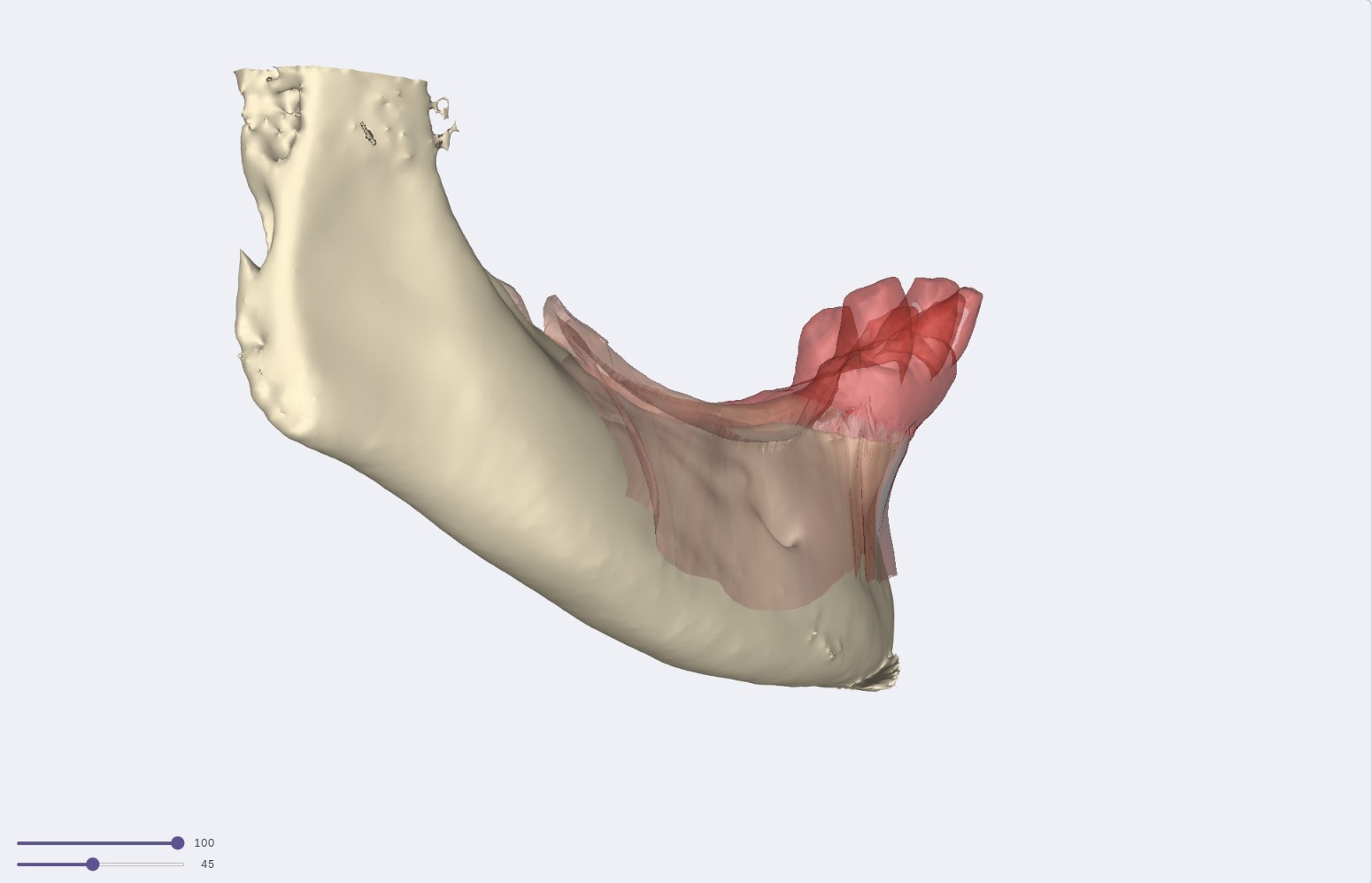 Malha do escaneamento em 3D, com uma região destacada em vermelho.